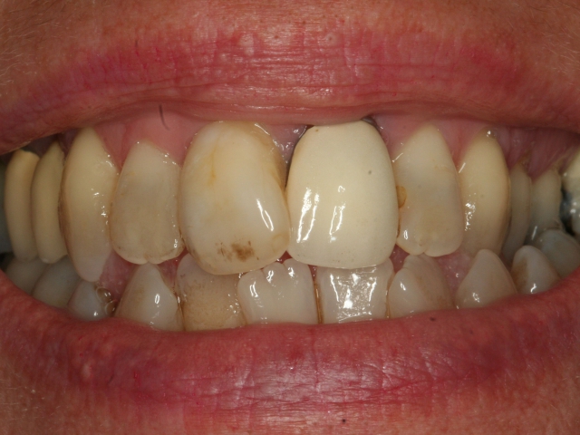 Esthetische tandheelkunde